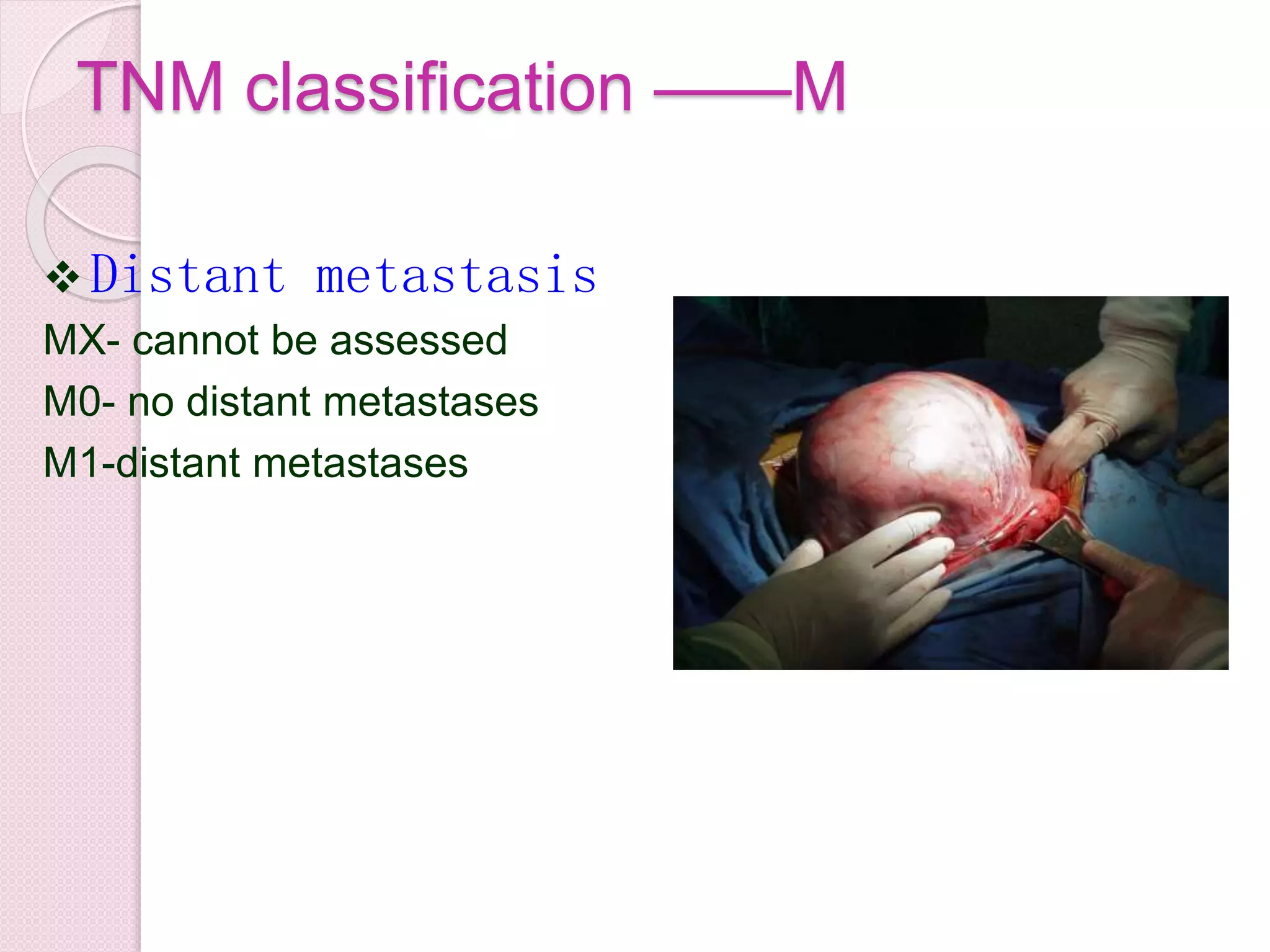 TNM classification ——M
 Distant metastasis
MX- cannot be assessed
M0- no distant metastases
M1-distant metastases
 