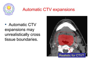 Realistic for CTV?
• Automatic CTV
expansions may
unrealistically cross
tissue boundaries.
Automatic CTV expansions
 