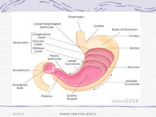 11/17/17 ASHISH TRIPATHI, RTIICS
 
