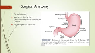 Surgical Anatomy
 Parts of stomach
 stomach is fixed at the
gastroesophageal (GE) junction and
pylorus
 large midportion is mobile
3
 