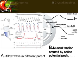 B.Muscel tension
created by action
potential peak.A. Slow wave in different part of
 