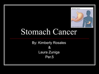 Stomach Cancer
By: Kimberly Rosales
&
Laura Zuniga
Per.5

 