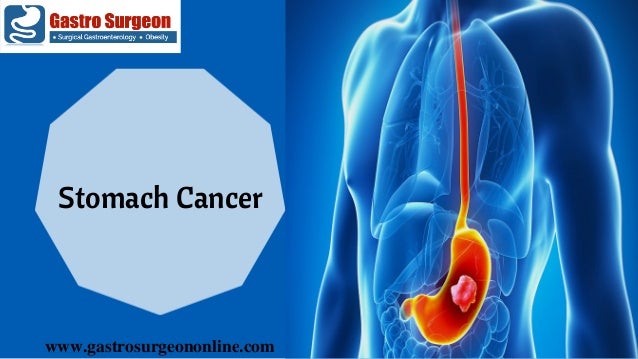 Stomach Cancer Treatment In Chennai | Stomach Cancer ...