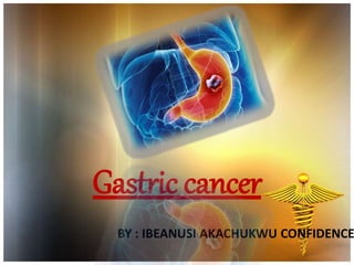 Gastric cancer
BY : IBEANUSI AKACHUKWU CONFIDENCE
 