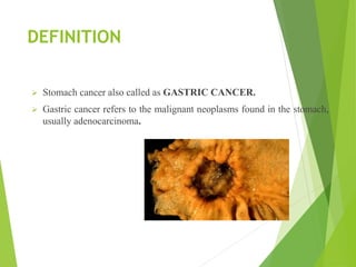 DEFINITION
 Stomach cancer also called as GASTRIC CANCER.
 Gastric cancer refers to the malignant neoplasms found in the stomach,
usually adenocarcinoma.
 