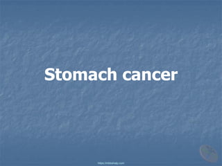 Stomach cancer
https://mbbshelp.com
 