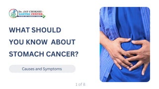 Causes and Symptoms
WHAT SHOULD
YOU KNOW ABOUT
STOMACH CANCER?
1 of 8
 