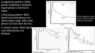 2.vagotomy pattern: Solid
phase emptying is delayed,
liquid phase is normal or
rapid .
3.Dumping pattern. Both
liquid and solid phases arc
abnormally rapid, with solid
phase t'/2 less than 30 min .
4. Gastric stasis. Both liquid
and solid phases are
delayed
B) after vagotomy :rapid
transit of liquid ,delayed
solid phase emptying.
Gastric stasis Dumping pattern
 