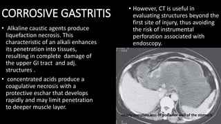 CORROSIVE GASTRITIS
• Alkaline caustic agents produce
liquefaction necrosis. This
characteristic of an alkali enhances
its penetration into tissues,
resulting in complete damage of
the upper GI tract and adj.
structures .
• concentrated acids produce a
coagulative necrosis with a
protective eschar that develops
rapidly and may limit penetration
to deeper muscle layer.
• However, CT is useful in
evaluating structures beyond the
first site of injury, thus avoiding
the risk of instrumental
perforation associated with
endoscopy.
nearly complete loss of posterior wall of the stomach
 