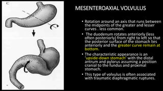 Stomach Rotation Radiology Stomach radiology | PPTX