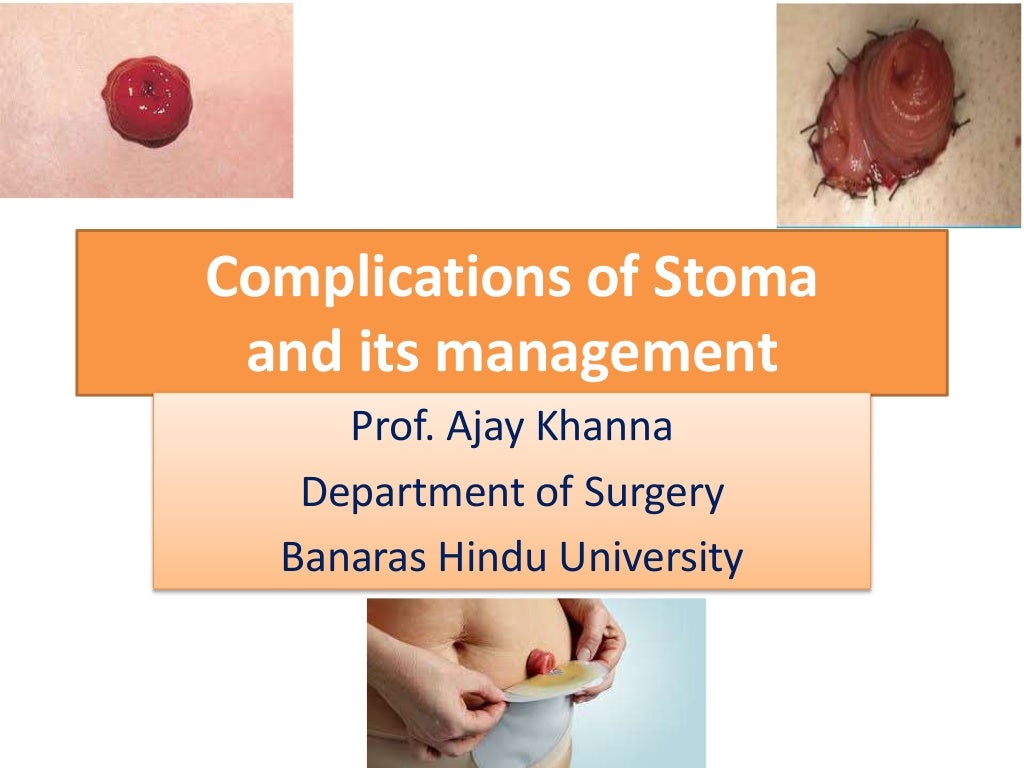 Stoma complications by Prof. Ajay Khanna, IMS, BHU, Varanasi India