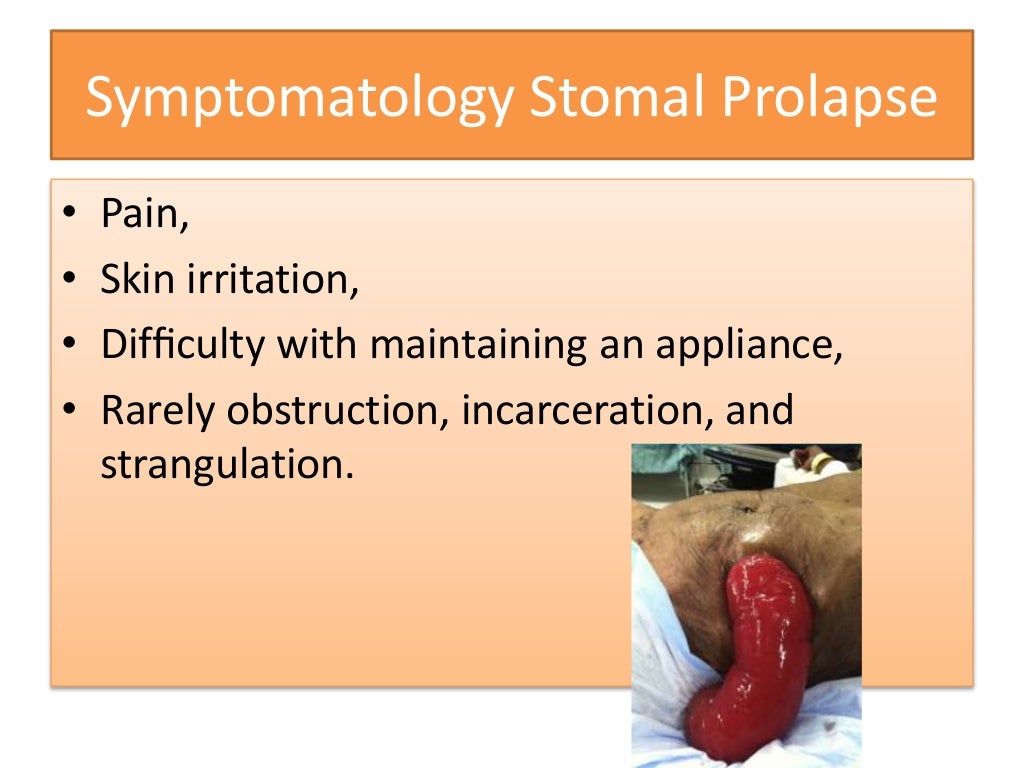 Stoma complications by Prof. Ajay Khanna, IMS, BHU, Varanasi India