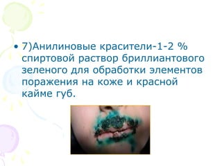 • 7)Анилиновые красители-1-2 % 
спиртовой раствор бриллиантового 
зеленого для обработки элементов 
поражения на коже и красной 
кайме губ. 
 