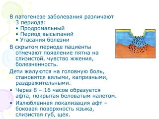 В патогенезе заболевания различают 
3 периода: 
• Продромальный 
• Период высыпаний 
• Угасания болезни 
В скрытом периоде пациенты 
отмечают появление пятна на 
слизистой, чувство жжения, 
болезненность. 
Дети жалуются на головную боль, 
становятся вялыми, капризными, 
раздражительными. 
• Через 8 – 16 часов образуется 
афта, покрытая беловатым налетом. 
• Излюбленная локализация афт – 
боковая поверхность языка, 
слизистая губ, щек. 
 