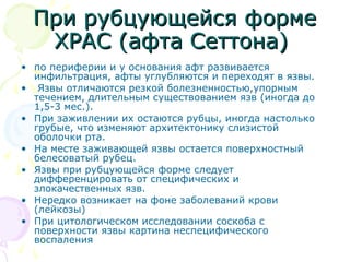ППррии ррууббццууюющщееййссяя ффооррммее 
ХХРРААСС (ааффттаа ССееттттооннаа) 
• по периферии и у основания афт развивается 
инфильтрация, афты углубляются и переходят в язвы. 
• Язвы отличаются резкой болезненностью,упорным 
течением, длительным существованием язв (иногда до 
1,5-3 мес.). 
• При заживлении их остаются рубцы, иногда настолько 
грубые, что изменяют архитектонику слизистой 
оболочки рта. 
• На месте заживающей язвы остается поверхностный 
белесоватый рубец. 
• Язвы при рубцующейся форме следует 
дифференцировать от специфических и 
злокачественных язв. 
• Нередко возникает на фоне заболеваний крови 
(лейкозы) 
• При цитологическом исследовании соскоба с 
поверхности язвы картина неспецифического 
воспаления 
 