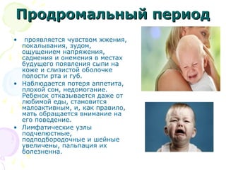 ППррооддррооммааллььнныыйй ппееррииоодд 
• проявляется чувством жжения, 
покалывания, зудом, 
ощущением напряжения, 
саднения и онемения в местах 
будущего появления сыпи на 
коже и слизистой оболочке 
полости рта и губ. 
• Наблюдается потеря аппетита, 
плохой сон, недомогание. 
Ребенок отказывается даже от 
любимой еды, становится 
малоактивным, и, как правило, 
мать обращается внимание на 
его поведение. 
• Лимфатические узлы 
подчелюстные, 
подподбородочные и шейные 
увеличены, пальпация их 
болезненна. 
 