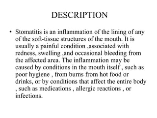 DESCRIPTION
• Stomatitis is an inflammation of the lining of any
of the soft-tissue structures of the mouth. It is
usually...