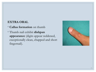 STOMATOGNATHIC SYSTEM and its implications in malocclusion | PPTX