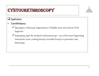 Stones & instrumentation | PDF