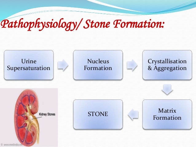 Stones Tumours Of Kidney Ppt By Smriti Singh