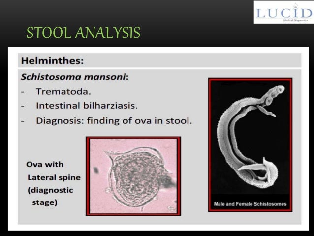 Stool analysis