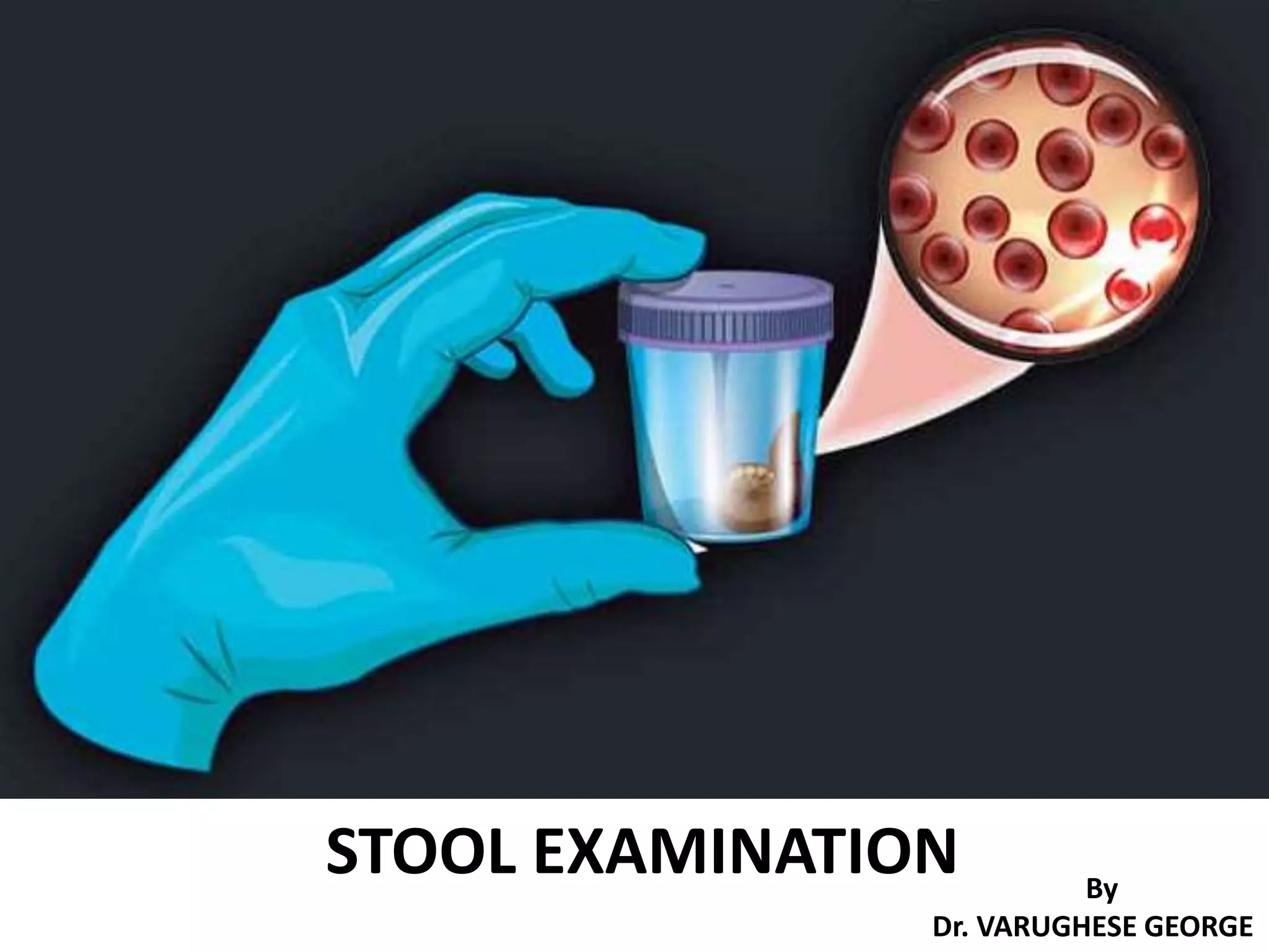 Stool Examination PPT