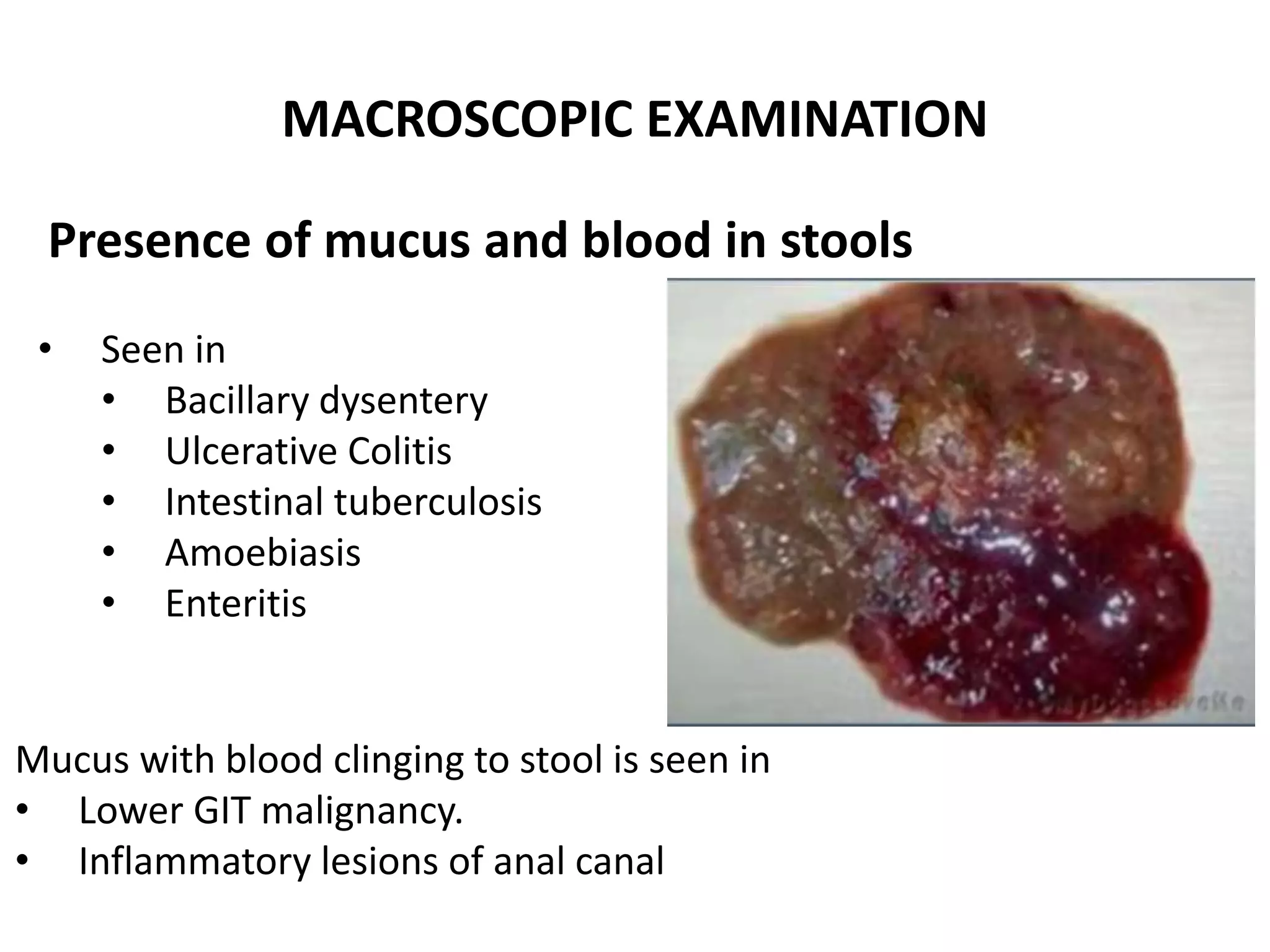 Stool Examination PPT