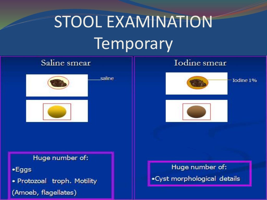 Stool examination dr.vinutha