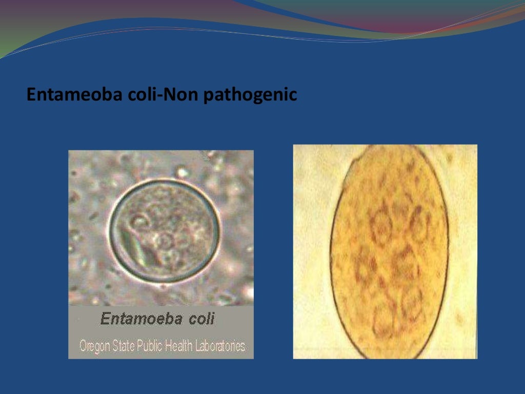 Stool examination dr.vinutha