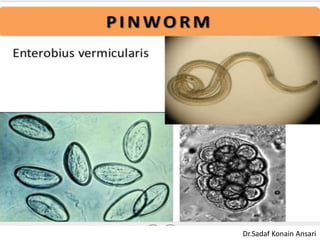 Dr.Sadaf Konain Ansari 
 