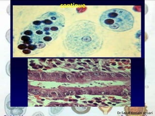 continue 
Dr.Sadaf Konain Ansari 
 