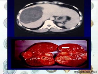 Dr.Sadaf Konain Ansari 
 