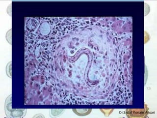 Dr.Sadaf Konain Ansari 
 