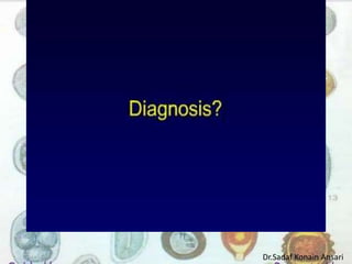 Dr.Sadaf Konain Ansari 
 