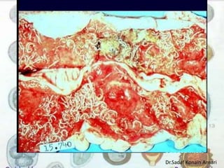 Dr.Sadaf Konain Ansari 
 