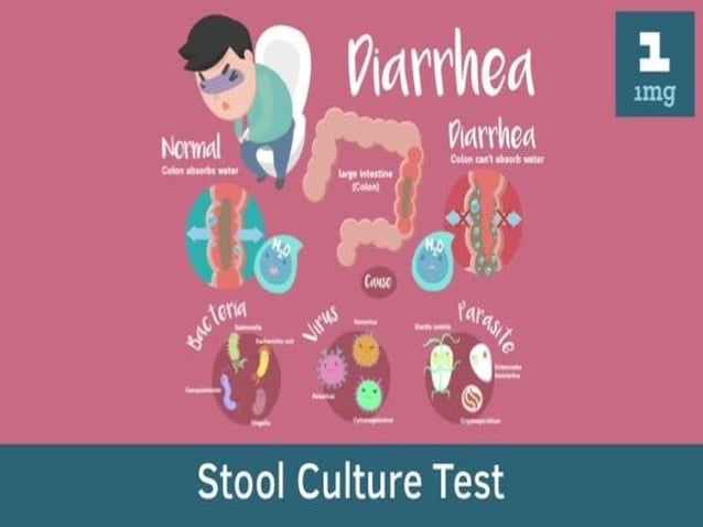 STOOL Routine Examination.pptxSTOOL Routine Examination.pptx