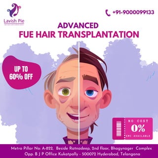 Hair Transplantation.pdf