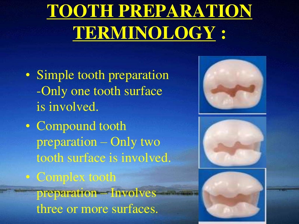 Principles of cavity preparation by Dr .rupali