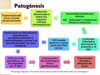 PatogénesisPatogénesis
Neonatología, Diagnostico y Tratamiento, Primera edición, Capitulo X, Enfermedades Infecciosas, Citomegalovirus
 