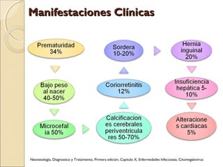 Manifestaciones ClínicasManifestaciones Clínicas
Neonatología, Diagnostico y Tratamiento, Primera edición, Capitulo X, Enfermedades Infecciosas, Citomegalovirus
 