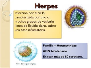 HerpesHerpes
Infección por el VHS,
caracterizada por uno o
muchos grupos de vesículas
llenas de líquido claro, sobre
una base inflamatoria.
Familia = Herpesviridae
ADN bicatenario
Existen más de 80 serotipos.
 