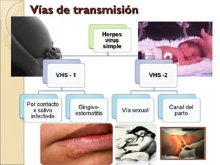 Vías de transmisiónVías de transmisión
 
