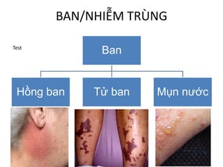 BAN/NHIỄM TRÙNG
Ban
Hồng ban Tử ban Mụn nước
Test
 