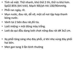 • Tỉnh vẻ mệt. Thở nhanh, khó thở 2 thì, thở ra khó hơn.
SpO2 85% (khí trời). Mạch 90l/ph HA 130/90mmHg.
• Phổi ran ngáy, rít.
• Mụn nước, đau rát, dễ vỡ, một số nơi tập hợp thanh
bóng nước.
• Vành tai 2 bên đau rát,đỏ tía.
• Loét miệng + môi đóng mày trắng.
• Loét da qui đầu dạng loét chợt nông đau rát d# 3x2 cm.
• Xq phổi tăng sáng nhẹ đáy phổi, ứ khí nhẹ vùng đáy phổi
hai bên.
• Men gan tang 3 lần bình thường
 