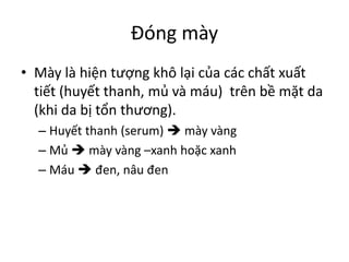 Đóng mày
• Mày là hiện tượng khô lại của các chất xuất
tiết (huyết thanh, mủ và máu) trên bề mặt da
(khi da bị tổn thương).
– Huyết thanh (serum)  mày vàng
– Mủ  mày vàng –xanh hoặc xanh
– Máu  đen, nâu đen
 