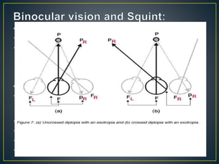 • Confusion-
due to different image viewed by two fovea
Immediately checked by cortical or retinal rivalry mechanism.
• Diplopia-
one object is perceived by one of the fovea of one eye and
other object is perceived by extrafoveal point of the other eye
which has a different localization value in space.
Binocular diplopia-single image on closing one eye
Monocular diplopia-in astigmatism,neurological conditions
Uncrossed diplopia-esodeviation
Crossed diplopia-exodeviation
 