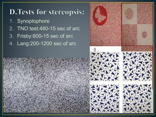 1. Synoptophore
2. TNO test:480-15 sec of arc
3. Frisby:600-15 sec of arc
4. Lang:200-1200 sec of arc
 