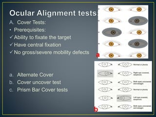 A. Cover Tests:
• Prerequisites:
Ability to fixate the target
Have central fixation
No gross/severe mobility defects
a. Alternate Cover
b. Cover uncover test
c. Prism Bar Cover tests
a
b
 