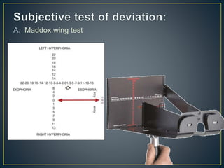 A. Maddox wing test
 