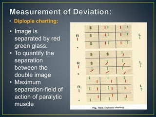 • Diplopia charting:
• Image is
separated by red
green glass.
• To quantify the
separation
between the
double image
• Maximum
separation-field of
action of paralytic
muscle
 